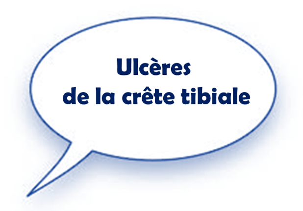 Fichier:Crête T1.png