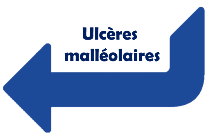 Fichier:Malléole bulle1.png