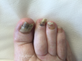 Ongles20.png