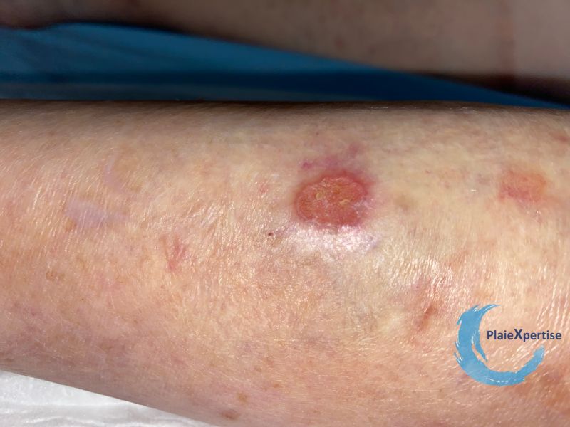 Fichier:Erosions post bulleuses8.jpg