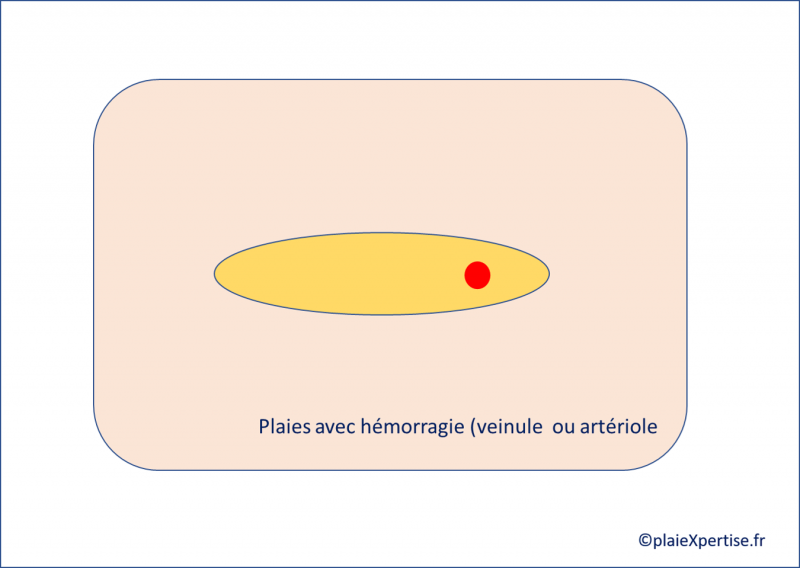 Fichier:X1.png