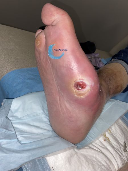 Fichier:Charcot53.jpg