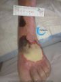 Cou de pied103.jpg