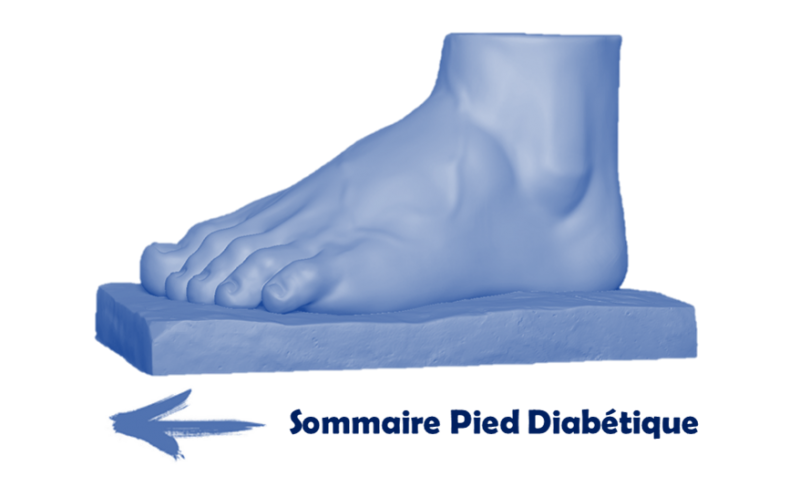 Fichier:Retour Pied.png