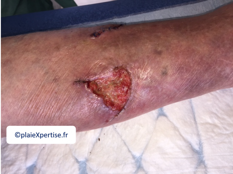 Fichier:DCT1.png