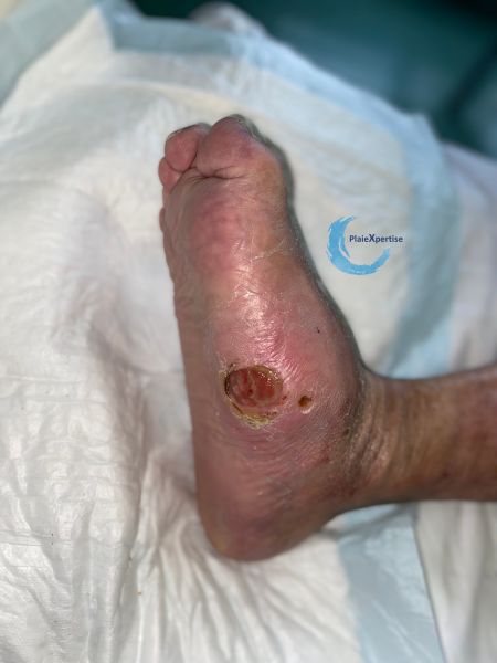 Fichier:Charcot57.jpg