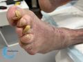 Ongles73.jpg