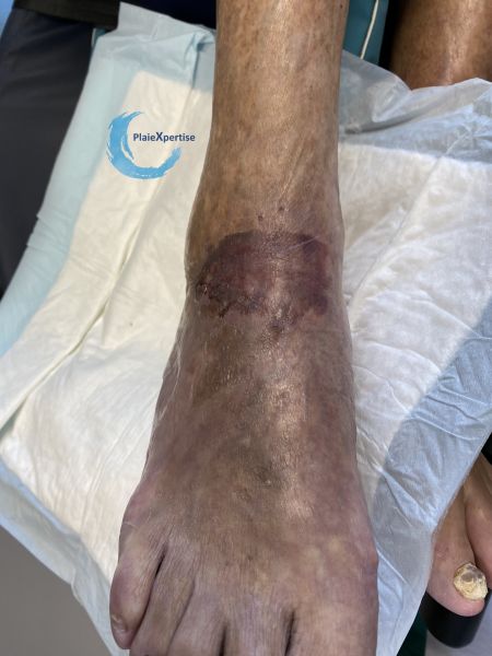 Fichier:Compression EI15.jpg