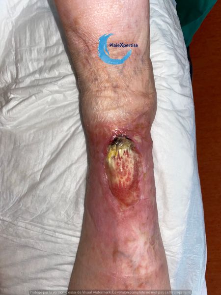 Fichier:Cou de pied109.jpg