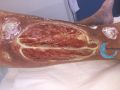 Tendon-Voussure22.jpg