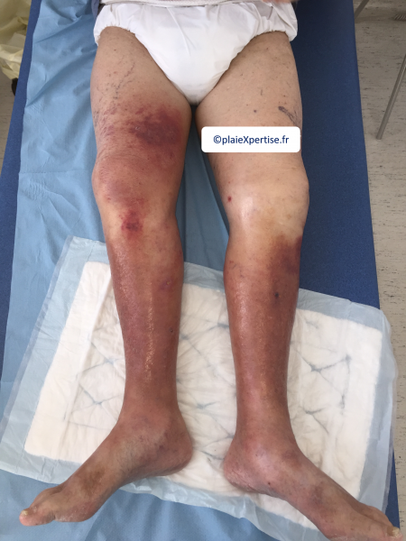 Fichier:Dermiteocre19.png