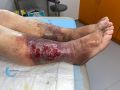 Dermiteocre88.jpg