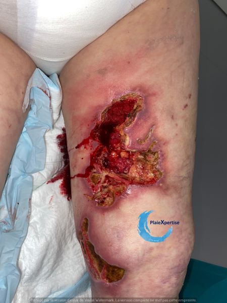 Fichier:Clciphylaxie 27.jpg