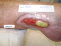 Tendon normal10.png