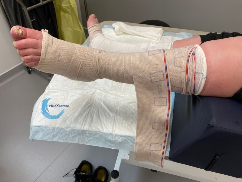 Fichier:Compression EI22.jpg