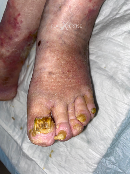 Fichier:Ongles45.png