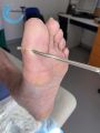 Plaies transfixiantes15.jpg