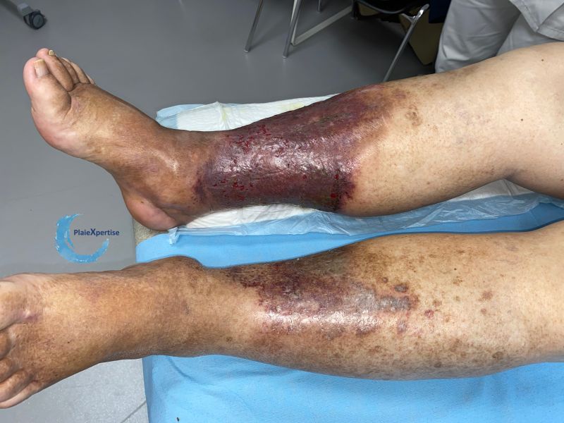 Fichier:Dermiteocre91.jpg