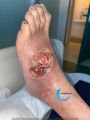 Cou de pied111.jpg
