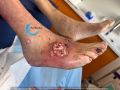 Cou de pied110.jpg