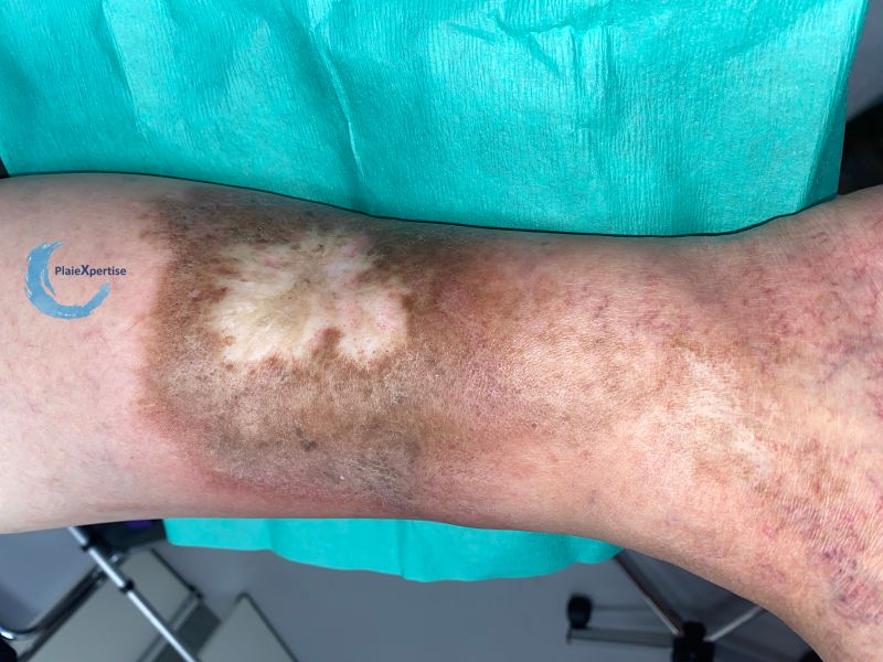 Fichier:Dermiteocre82.jpg