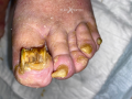 Ongles46.png