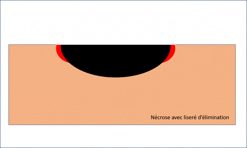 Fichier:LE2.png