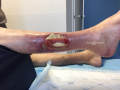 Tendon normal27.png