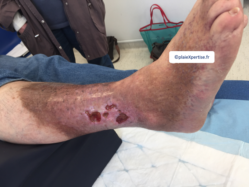 Fichier:Dermiteocre10.png