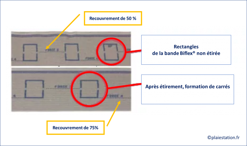 Fichier:Veine32.png