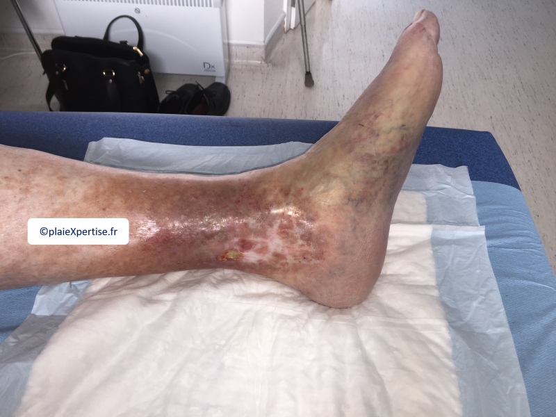 Fichier:Dermiteocre15.png