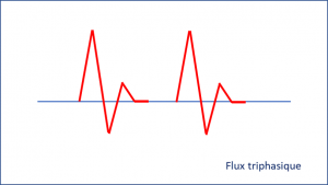 Fluxtri.png