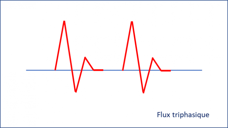 Fichier:Fluxtri.png