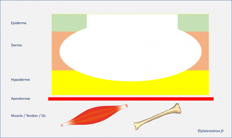 Fichier:Cav4.png