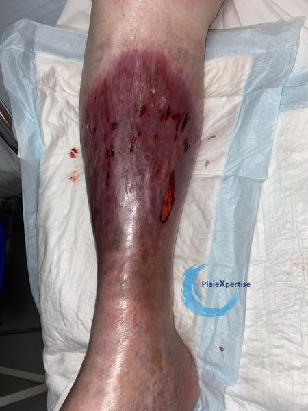 Fichier:Dermiteocre69.jpg