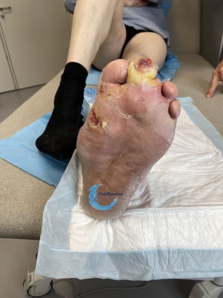 Fichier:Charcot54.jpg