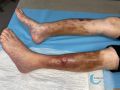 Dermiteocre84.jpg