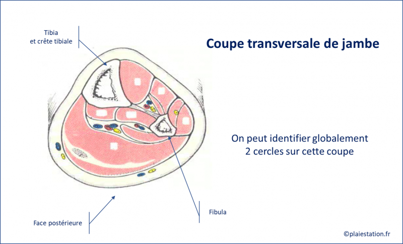 Fichier:Veine15.png