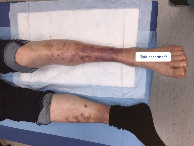 Fichier:Dermiteocre13.png