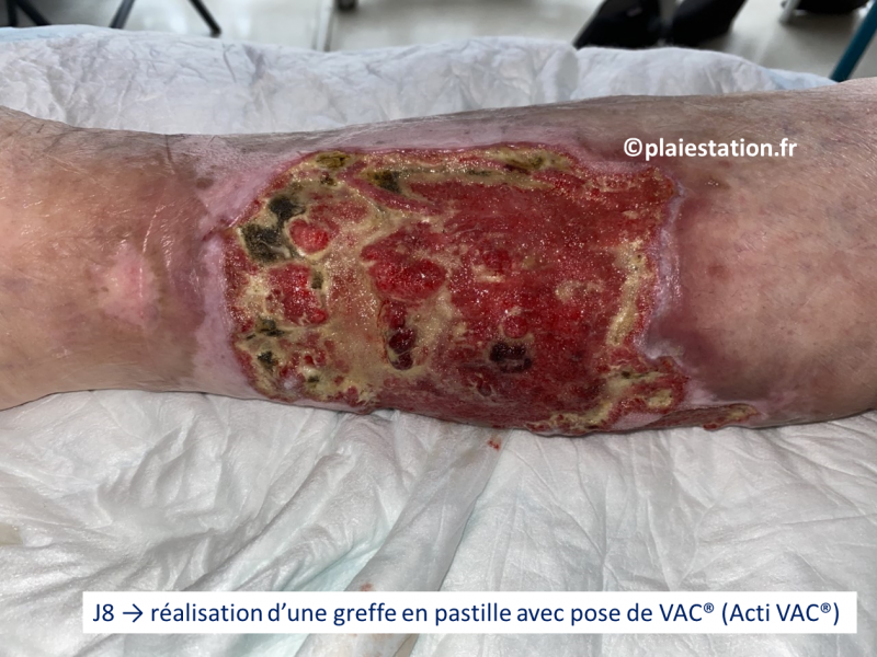 Fichier:JL5.png