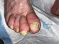 Ongles50.jpg