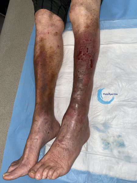 Fichier:Dermiteocre94.jpg