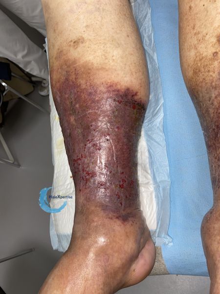 Fichier:Dermiteocre89.jpg