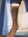 Dermiteocre22.png