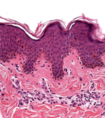 Histologie cutanée.png