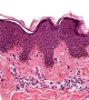 Histologie cutanée.png