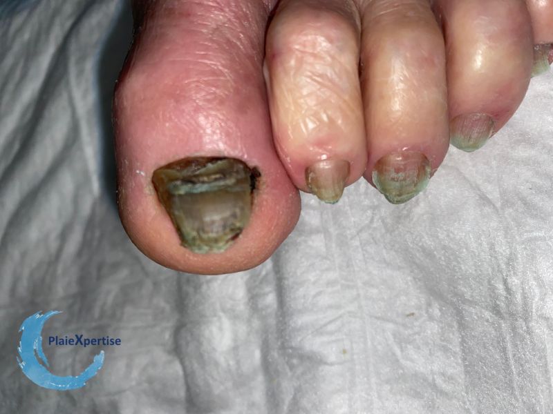 Fichier:Ongles71.jpg