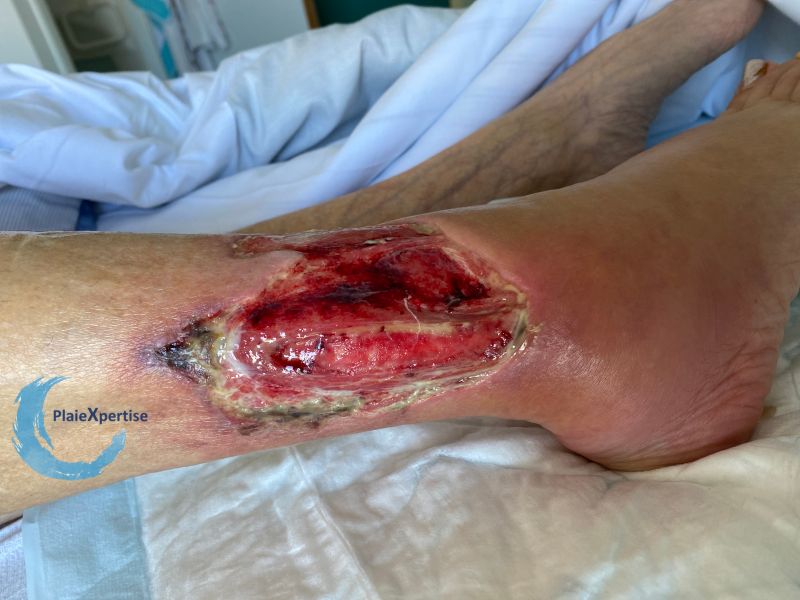 Fichier:Tendon-Reliquat19.jpg
