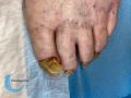 Ongles69.jpg