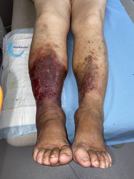 Fichier:Dermiteocre87.jpg